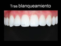 092-fianl con fondo y aguas